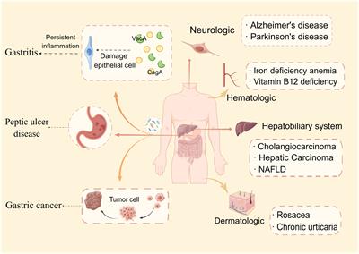 Frontiers Helicobacter pylori infection a dynamic process from